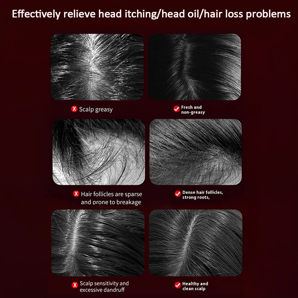 GlowScalp™ - Electric Scalp Massage Brush with Red Light